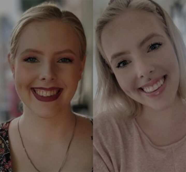 Invisalign®